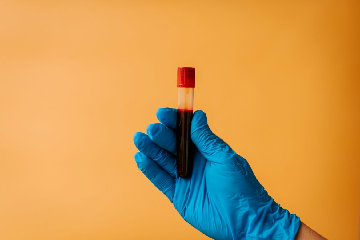 Blue-gloved hand holding a blood sample vial with a red cap against an orange background, close-up.