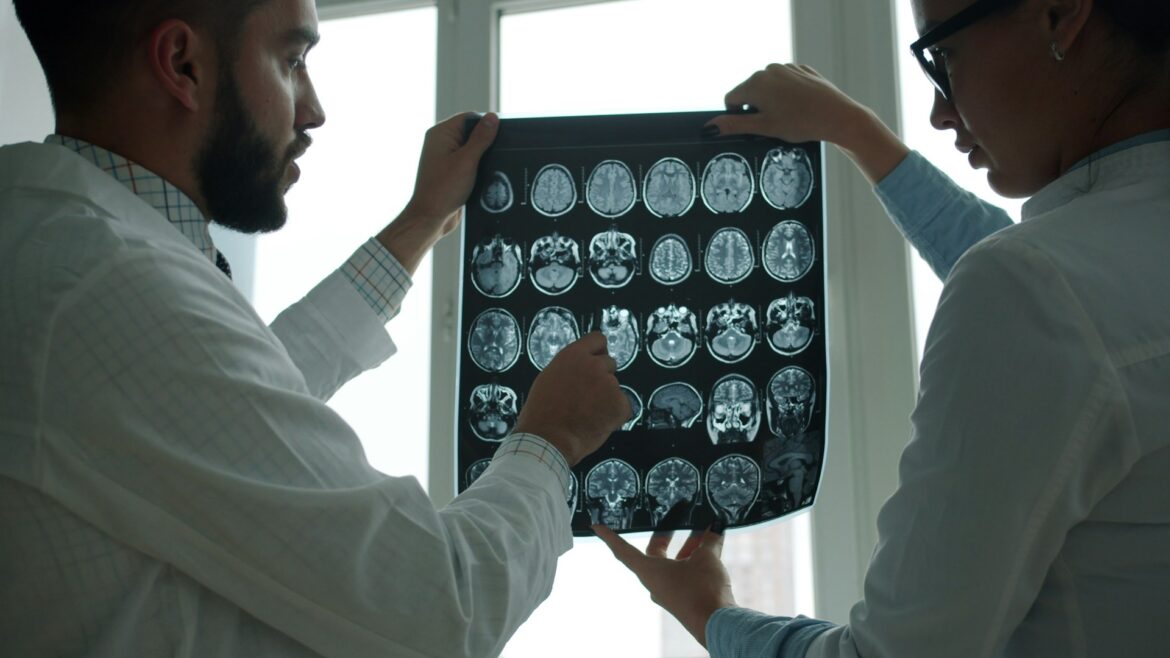 Two doctors in white coats hold up a large brain MRI film and review the images together by a bright window.