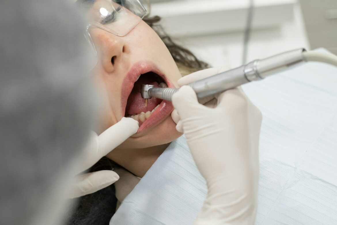 Close-up of a patient with mouth open while a dentist uses a dental drill; clinician wears gloves and protective glasses nearby, procedure in progress.
